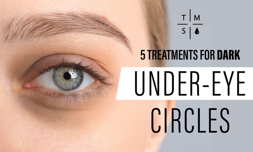 Dark Circles